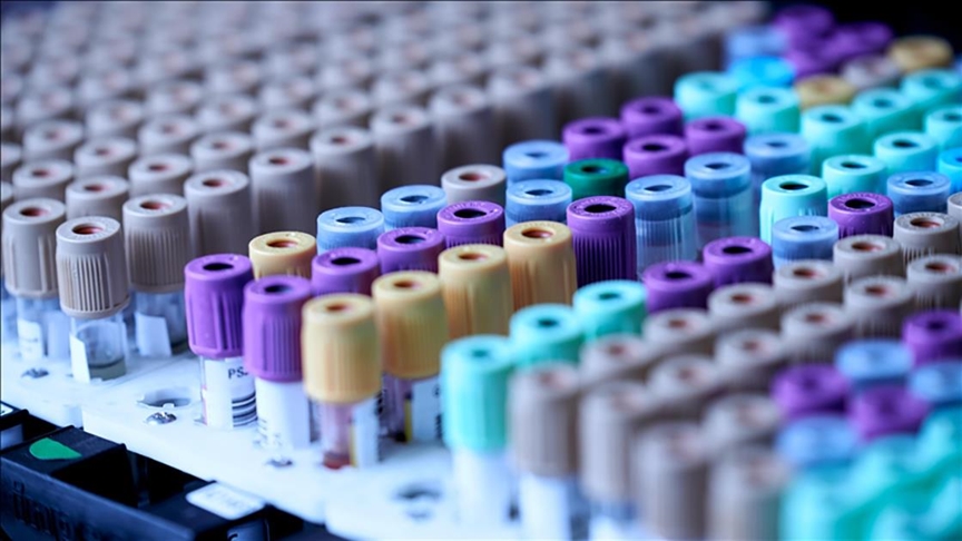 La cifra de casos de "misterioso" virus de la hepatitis a nivel mundial superó los 610 en 31 países