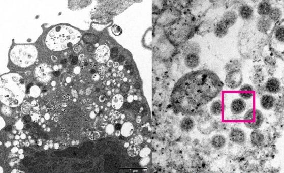 EEUU registra su primera muerte a causa de la variante ómicron del coronavirus