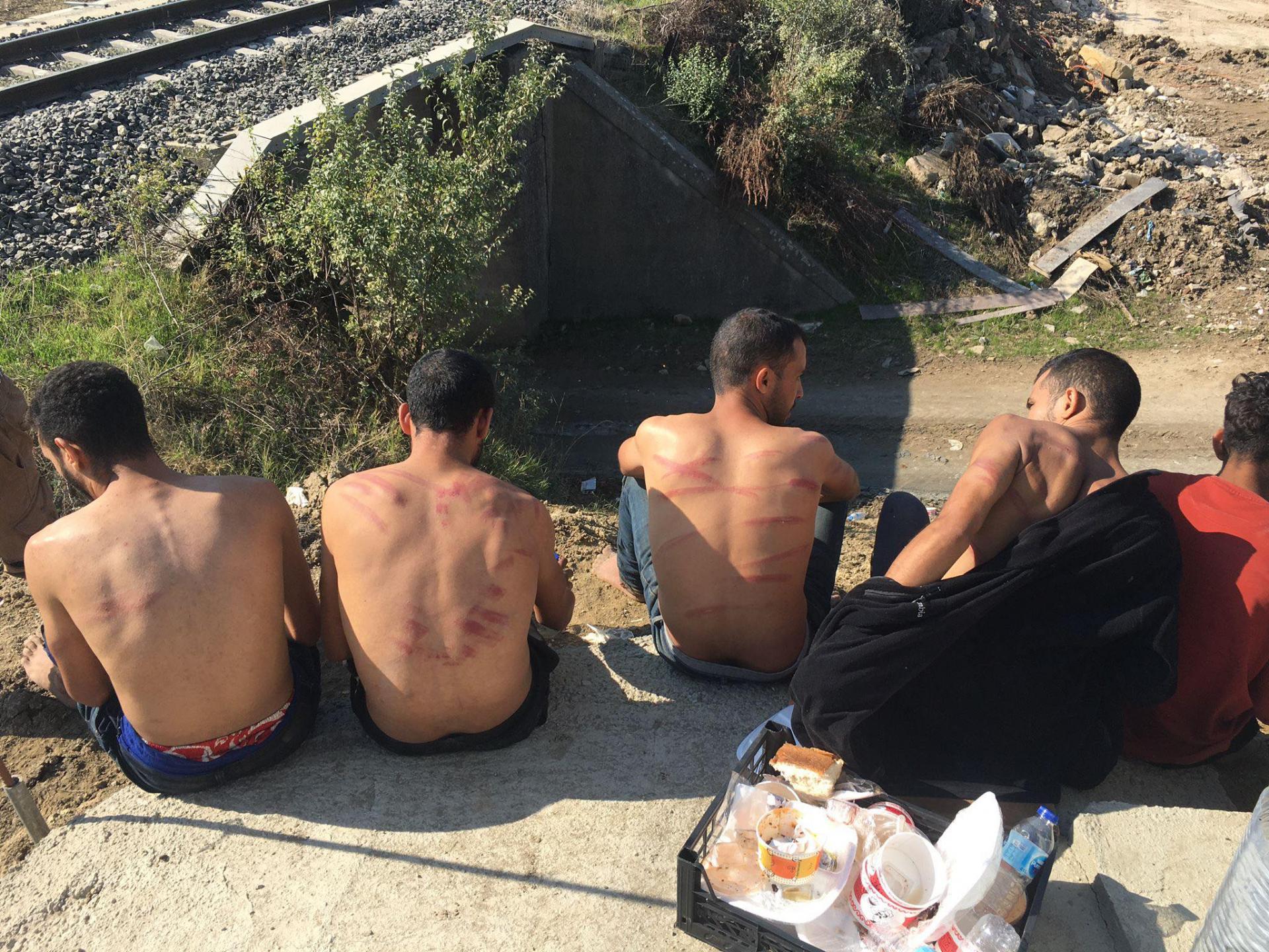 Turqia shëron emigrantët e rrahur nga ushtarët grekë