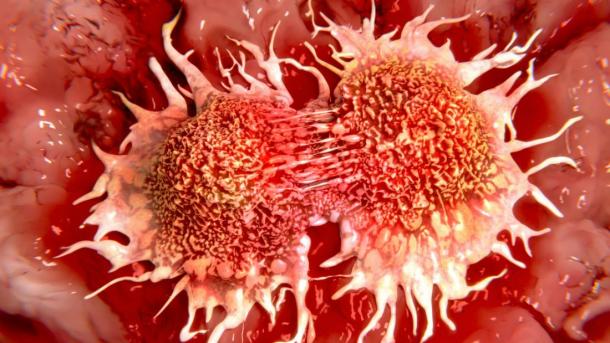 En 2015, 1,3 million de personnes ont perdu la vie dans l’UE en raison d’un cancer