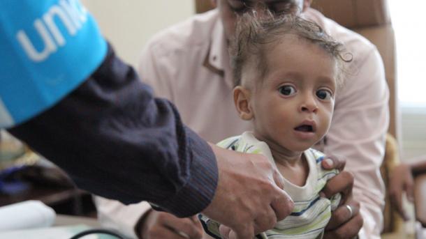 UNICEF u Jemenu pomogao 16.000 neuhranjene djece