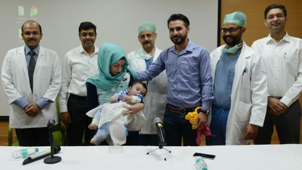 Un bébé à huit bras et jambes opéré avec succès en Inde