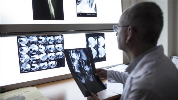 Probada la primera radiografía tridimensional a color en un humano