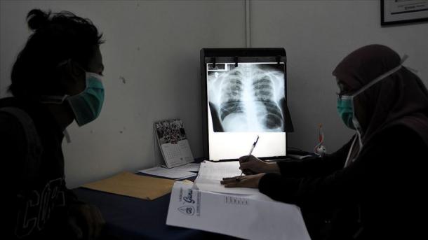 OBSH: Tuberkulozi shkakton vdekjen e rreth 4.500 personave çdo ditë