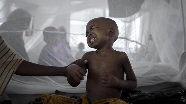 Kenyada xoleri epidemiyasi xavfi e'lon qilindi...