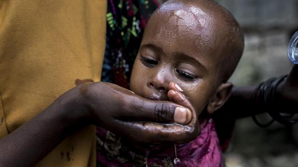 6,2 millones de somalíes necesitan urgente ayuda humanitaria