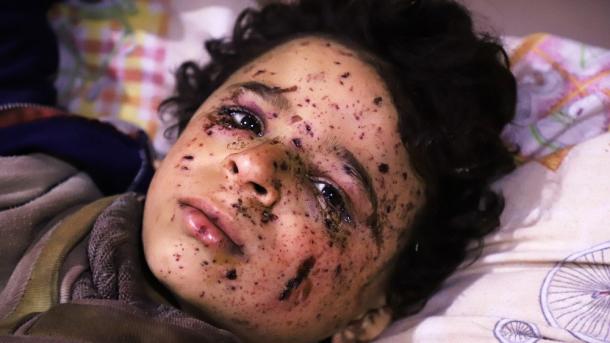 Um novo massacre à frente dos olhos do mundo: Guta Oriental