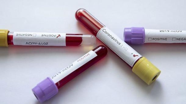 Coronavirus: Rasha da Amurka na zargin juna