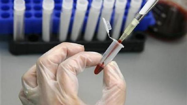 Brazili kaplohet nga epidemia e "etheve të verdha"