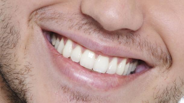 تیشلرینگیزنی آپپاق قیلیش نینگ اینگ آسان یولی