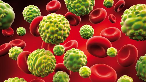 Descubren una proteína clave en la progresión de los gliomas