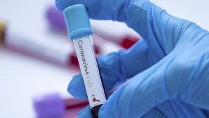 Tön'yaq Koreyada koronavirus yoqtıruçılar 2 million