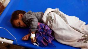 درخواست یمن از سازمان ملل برای مبارزه با وبا