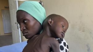 Epidemie de rujeolă în Nigeria: 19 copii au murit