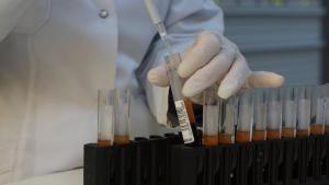 1,8 milioane de nigerieni sunt infectați cu SIDA