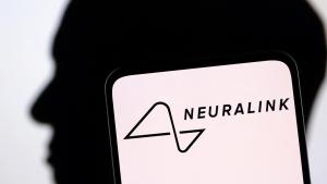 Elon Musk agychip cége megkezdi a klinikai teszteket