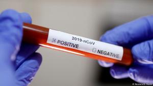 Turchia,nelle ultime 24 ore altre 25 persone hanno perso la vita dal coronavirus