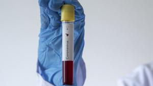 Coronavirus en Turquía: confirman 356 muertos