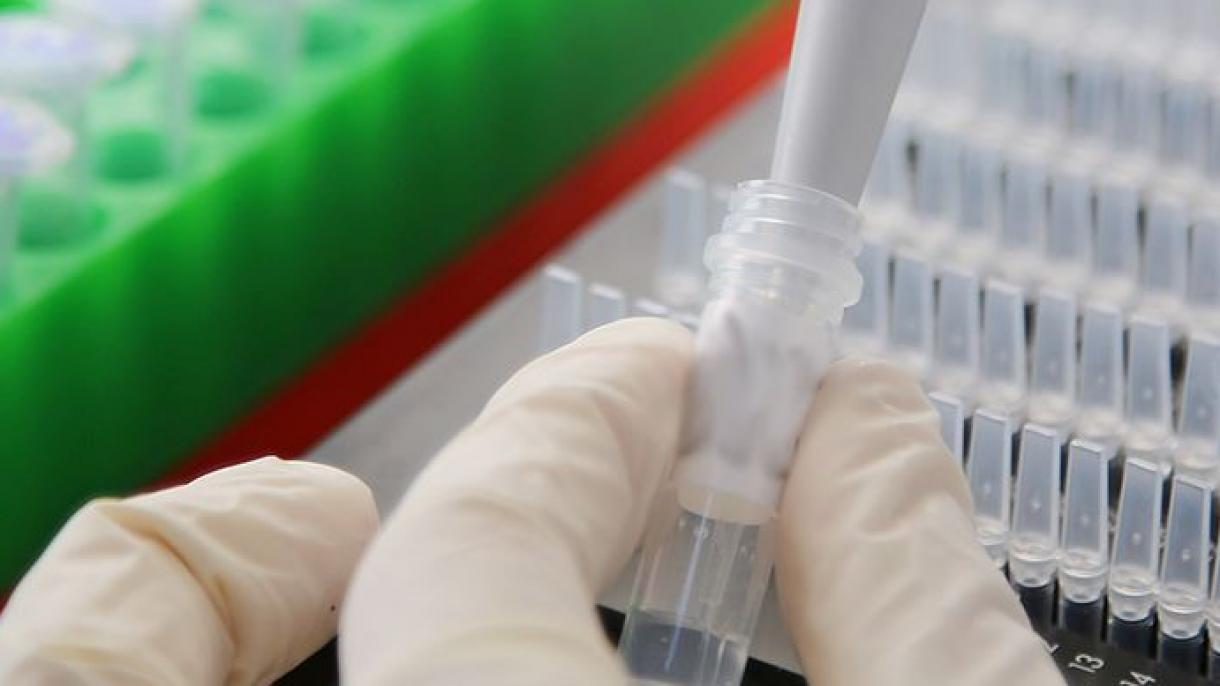 ئامېرىكادا بىر تۈرك دوختۇر ۋىرۇس بىلەن يۇقۇملىنىپ ۋاپات بولدى