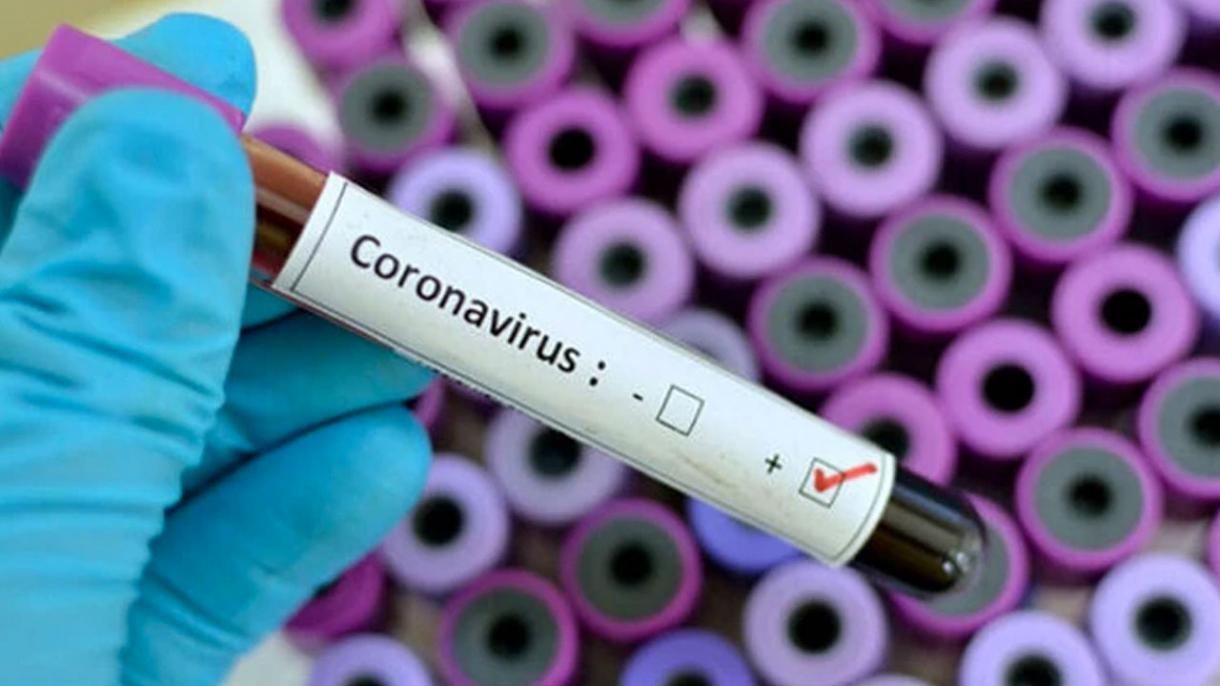 "کورونا وائرس" ہلاک شدگان کی تعداد 80 ہو گئی