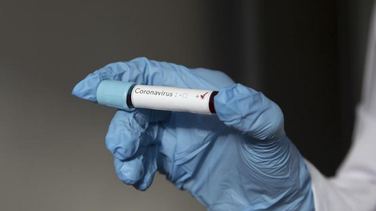 Kovid -19 nı ciňgӓn keşelӓrgӓ virus qabat yoğamı?