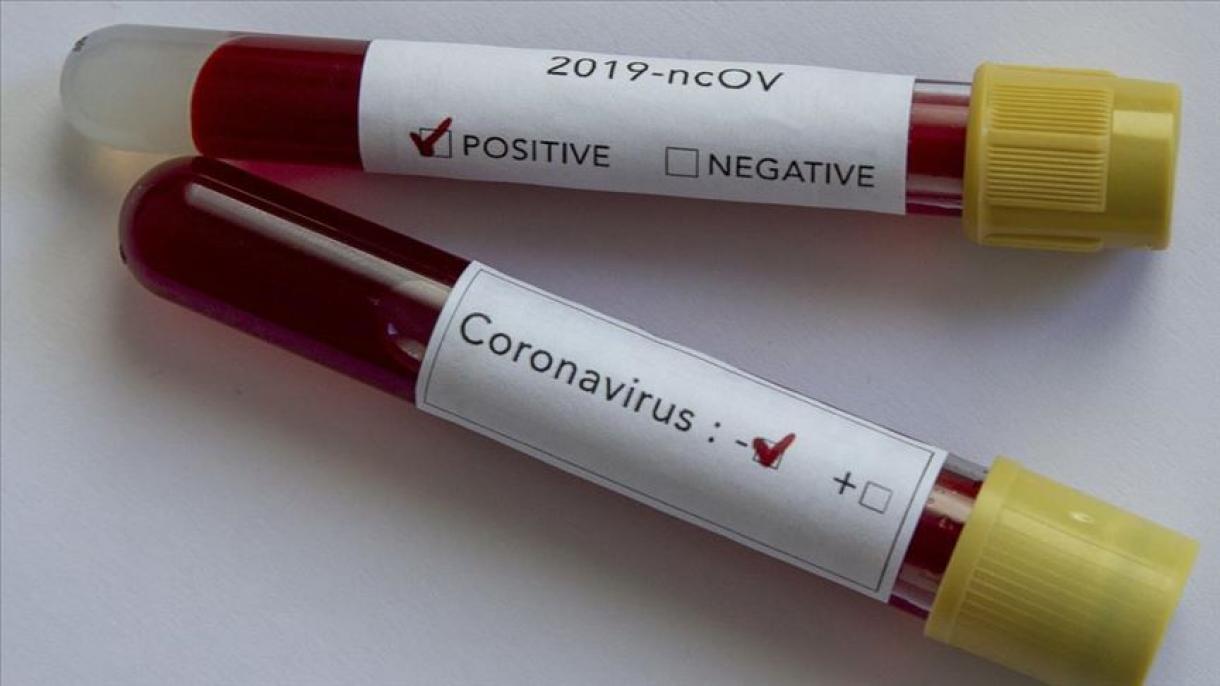 Coronavirus, Turchia, sale a 425 il numero delle perdite di vita a causa di Covid-19