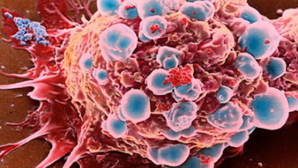 سرطان زدہ خلیات کو ہلاک کرنے کاطریقہ دریافت