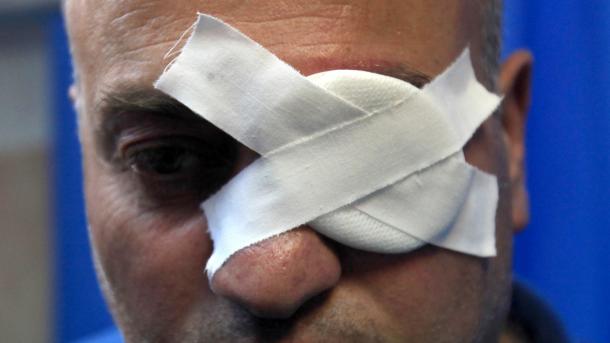 اسرائیلی فوجی نے فلسطینی رپورٹر کی آنکھ کو زخمی کر دیا