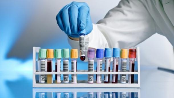 Brasil y otros ocho países prevén eliminar la hepatitis C para 2030