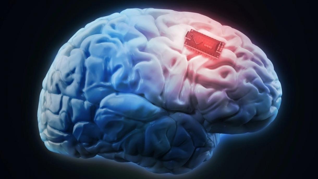 Beyin implantları hazırlanır
