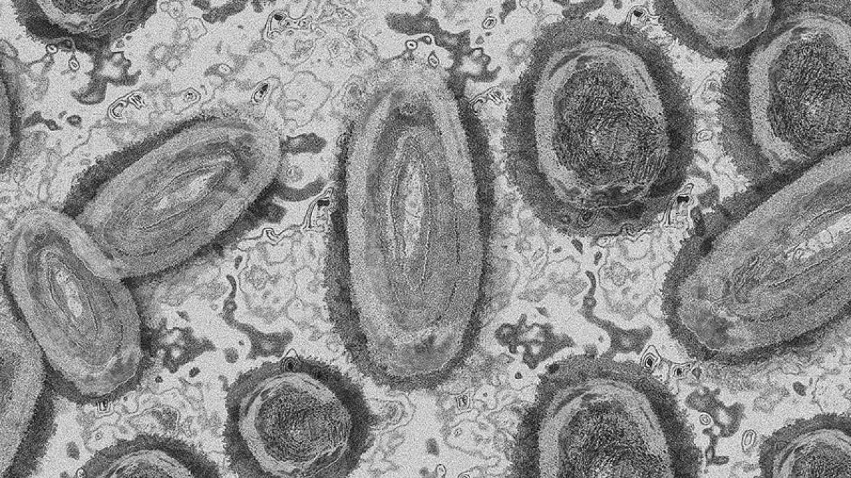 世卫组织:预计猴痘病毒不会变成新的流行病