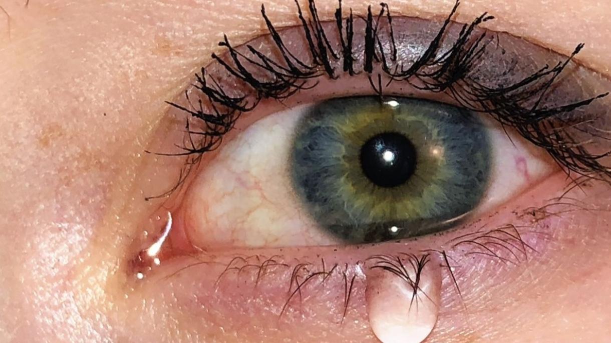 Expertos chinos descubren coronavirus en la lágrima de un paciente infectado
