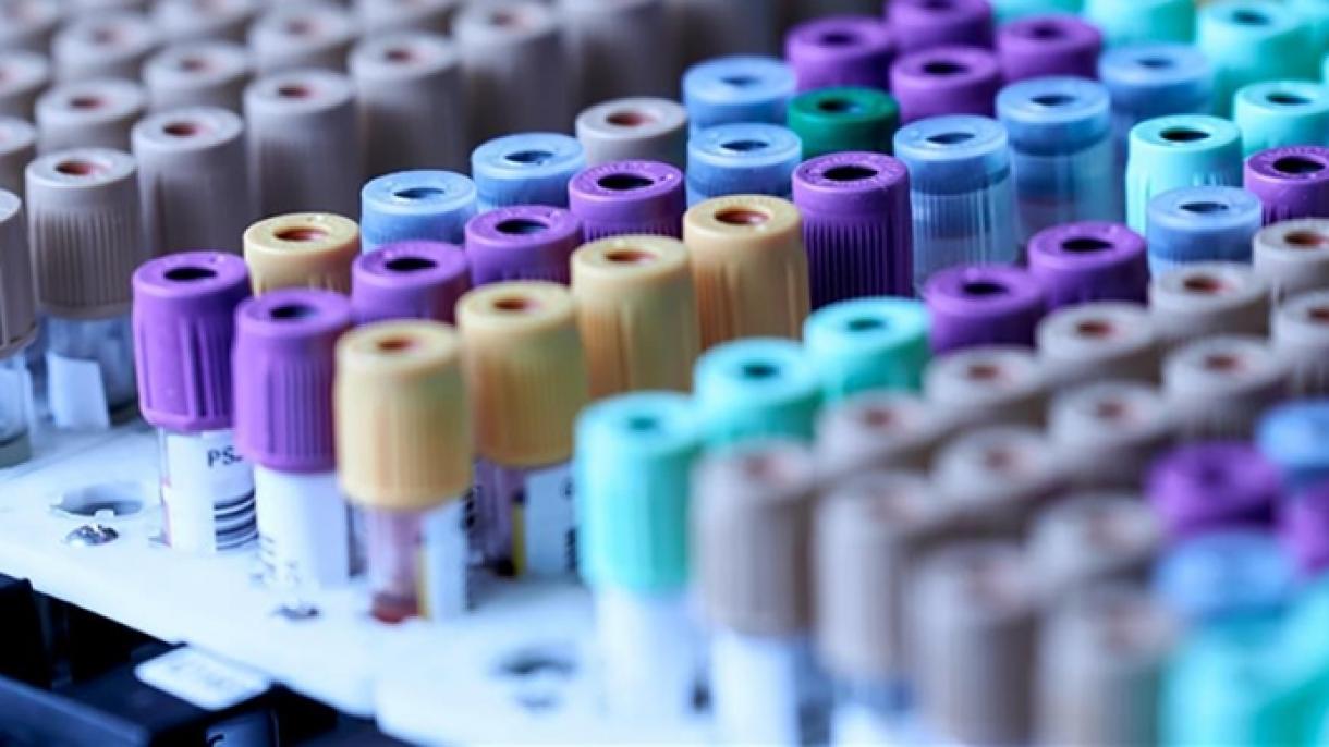La cifra de casos de "misterioso" virus de la hepatitis a nivel mundial superó los 610 en 31 países