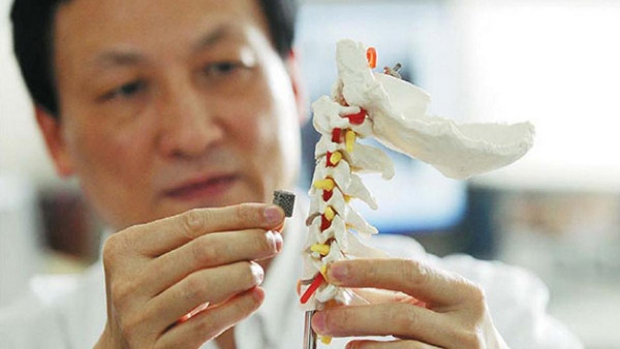 Un sistema desarollado para mejorar los implantes de columna vertebral