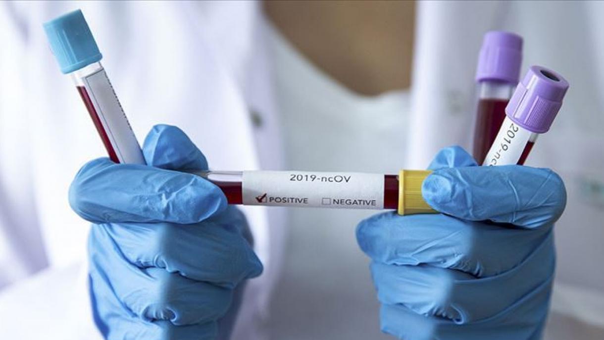 Turquía ha realizado en torno a 116.000 pruebas de coronavirus en las últimas 24 horas