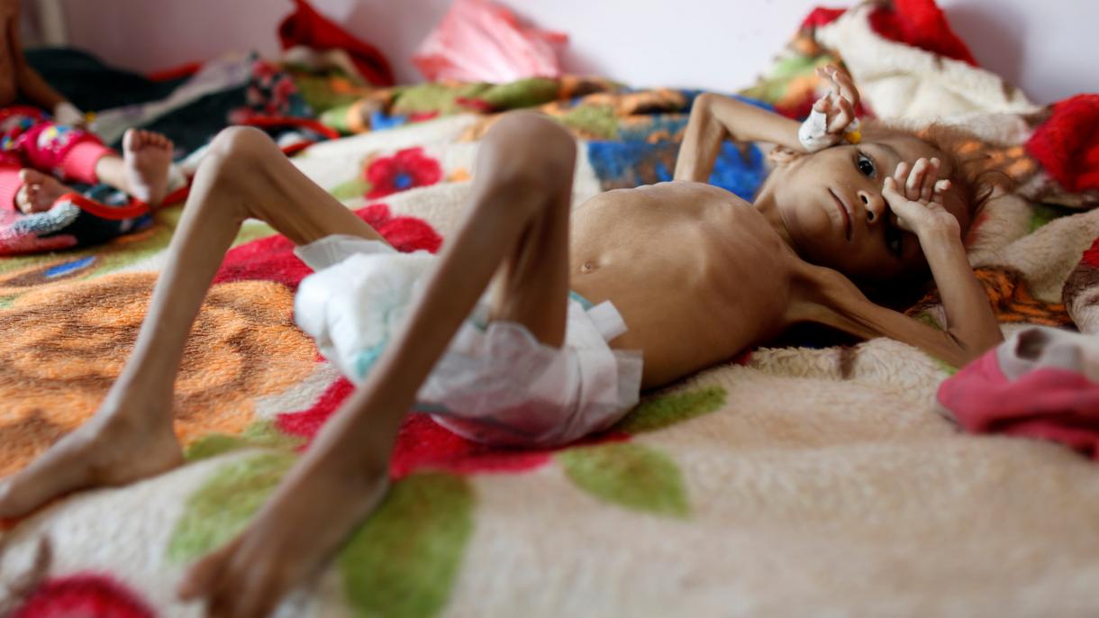 “El riesgo de hambruna en Yemen es muy grave”