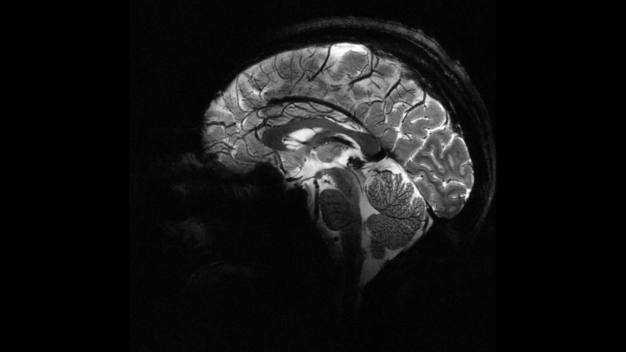 Készült az emberi agy legtisztább képe
