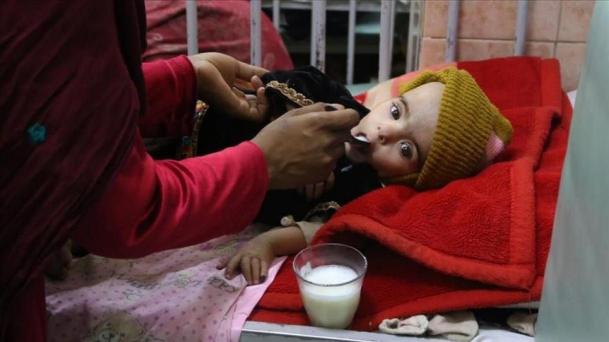 افزایش تعداد اطفال میتلا یه سوءتغذی در افغانستان