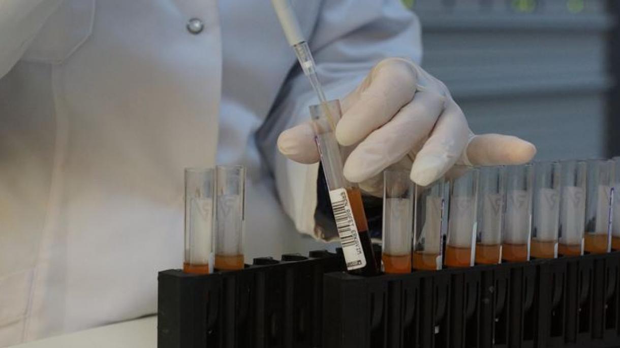 En Nigeria hay cerca de 1,8 millones de pacientes de SIDA