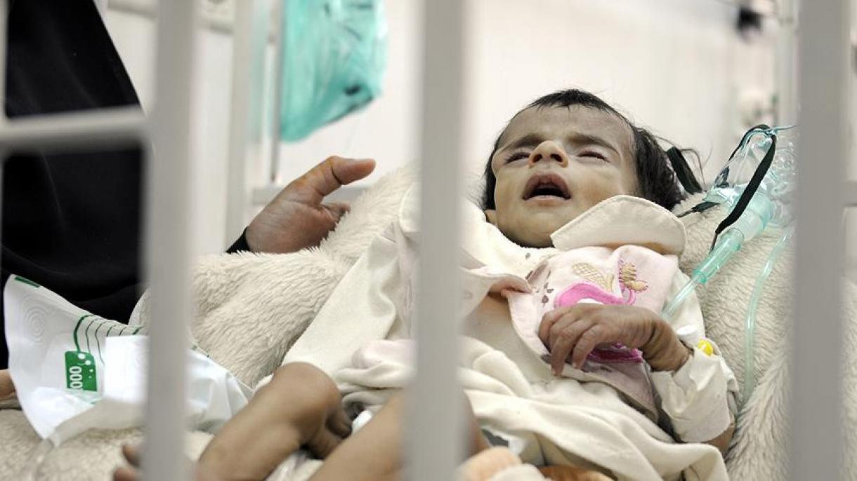 نیم میلیون کودک یمنی با خطر مرگ مواجه اند