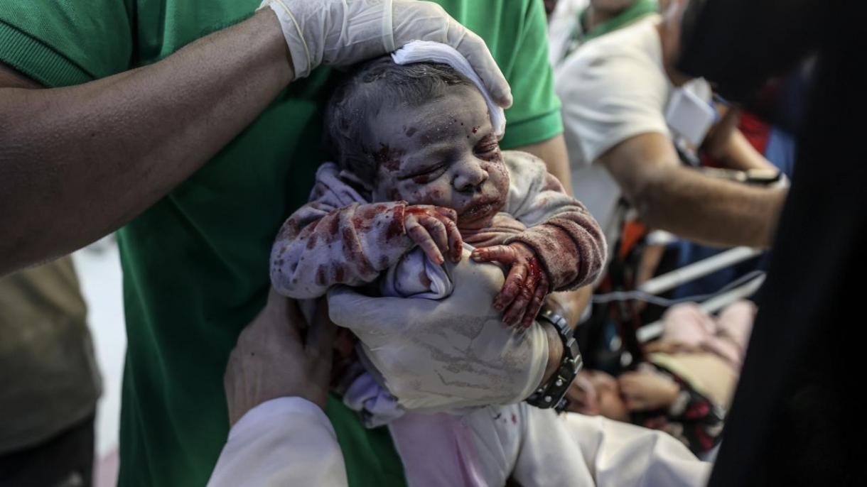 استعفای یکی از مدیران سازمان ملل در واکنش به نسل کشی در غزه