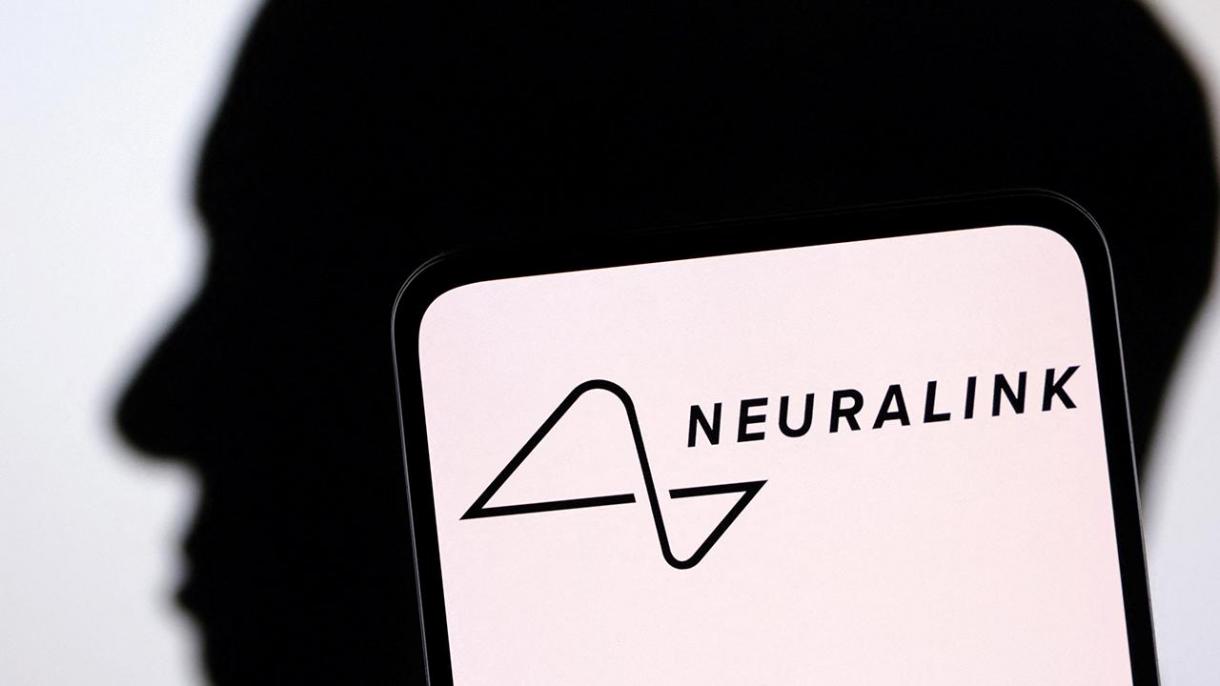 埃隆·马斯克的Neuralink 公司获脑芯片人体测试批准