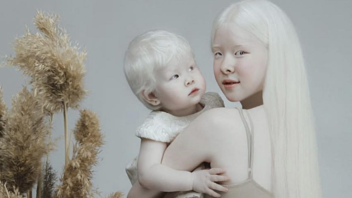 Albino sestre, poznate kao "bele princeze", privlače pažnju modnog sveta