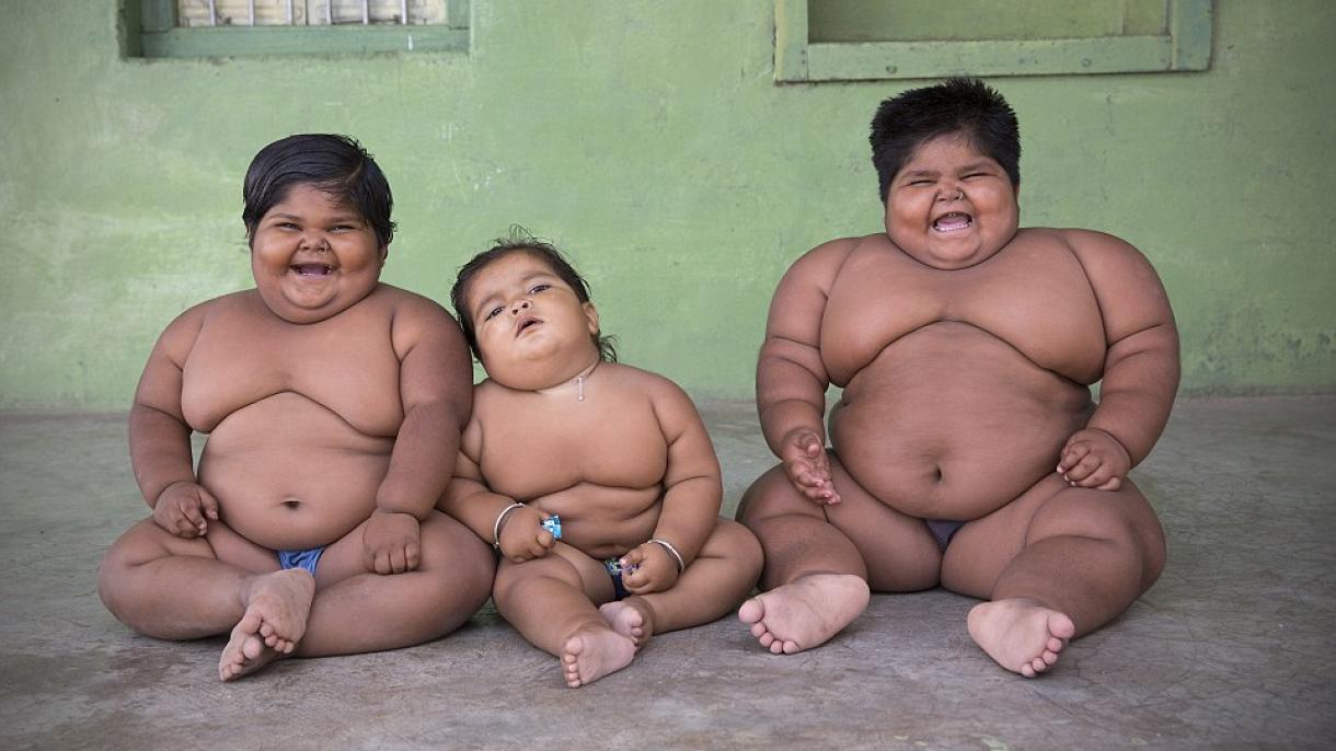 دنیا بھر میں 124 ملین بچے موٹاپے کا شکار