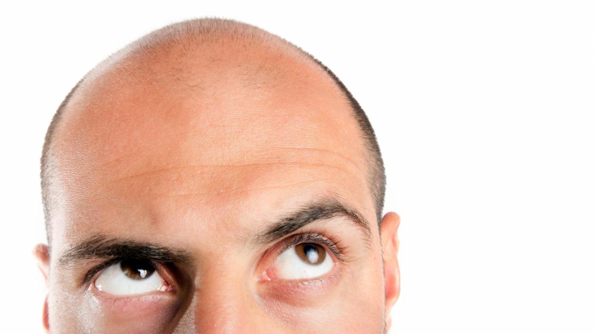 Crean tratamiento para combatir alopecia a base de nuez