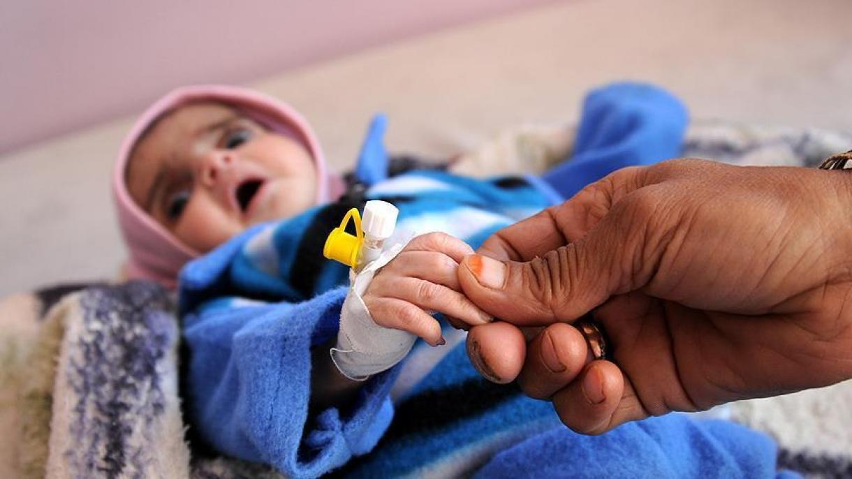Uma criança morre a cada 10 minutos no Iêmen