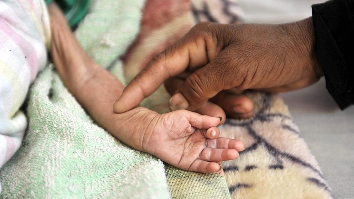 Yemen: al menos 100 personas van a hospitales por el brote de cólera