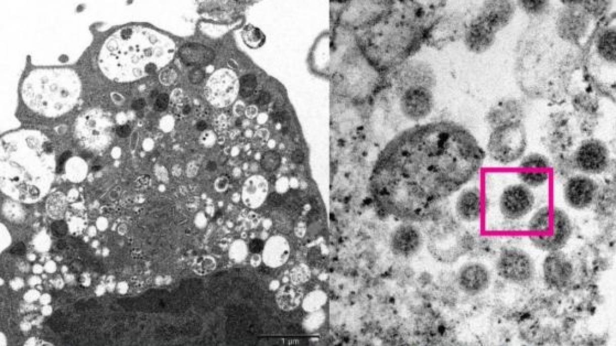 Учените показаха изображение на новия щам на коронавируса "Omicron"