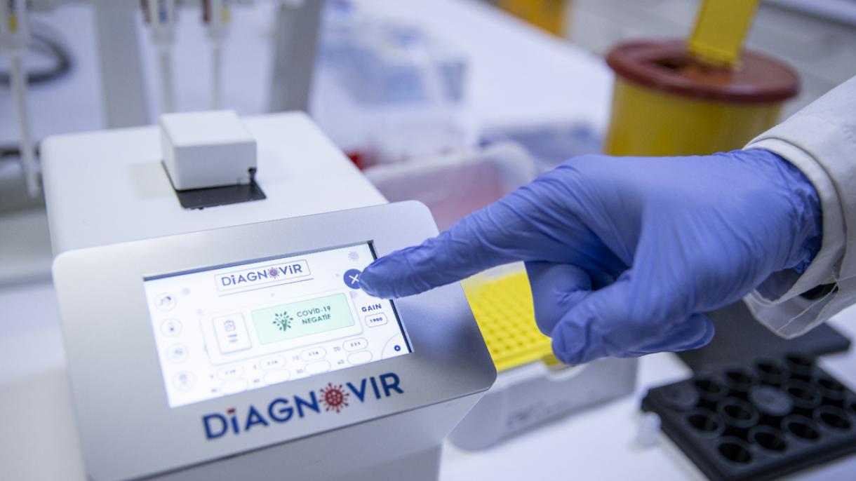 Sistemi “Diagnovir” i shkencëtarëve turq diagnostikon COVID-19 për 10 sekonda me saktësi 99%