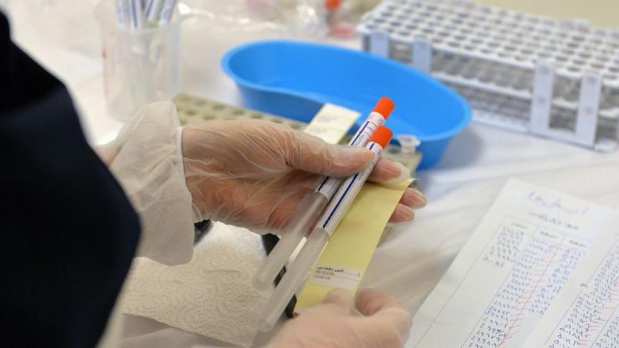 Os cientistas turcos trabalham sem parar para encontrarem uma cura para o coronavírus